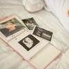 [연세아란산부인과 장성호 대표원장 칼럼] 두려움에서 설렘으로, 분만 방식의 진화…산부인과 병원이 바꾸는 출산 문화
