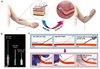 KAIST 정재웅‧정원일 교수 연구팀, 혈관‧조직 손상 막는 주삿바늘 개발