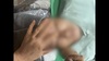 불법 수술로 10억여 원 챙긴 병원 대표와 간호조무사 덜미